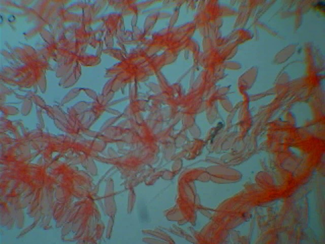 Cortinarius candelaris?